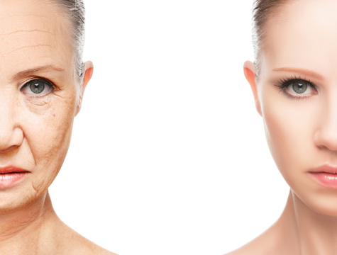 reverse aging effects with fraxel laser surgery vitenas
