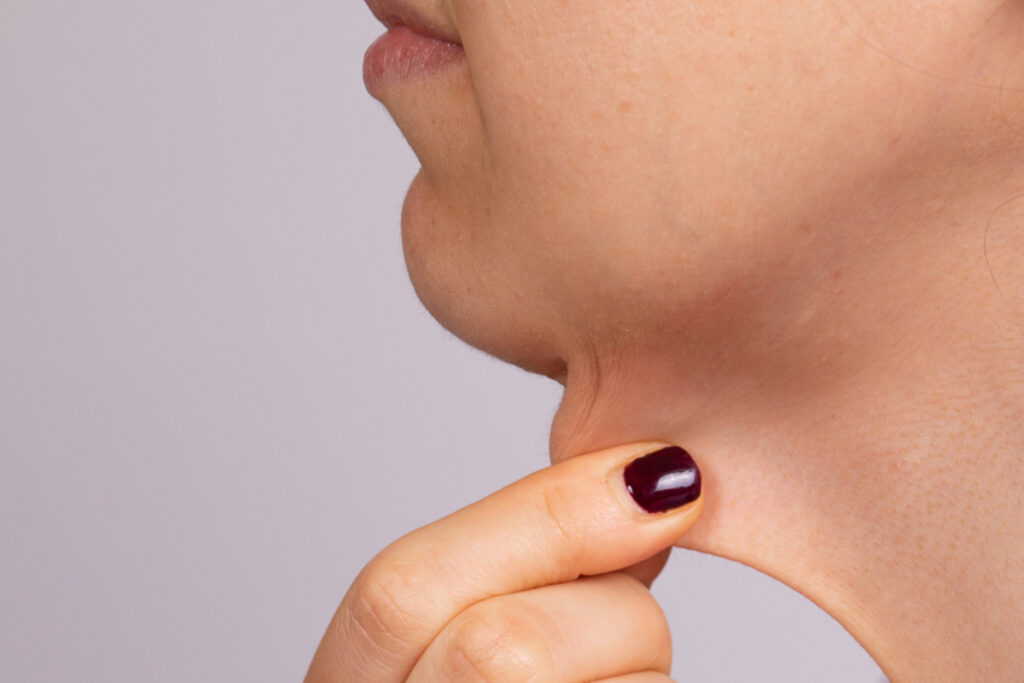 The Dreaded "Turkey Neck" and What to Do About It