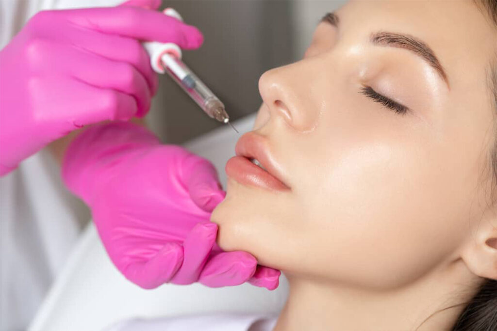 Lip Filler Dos & Don’ts