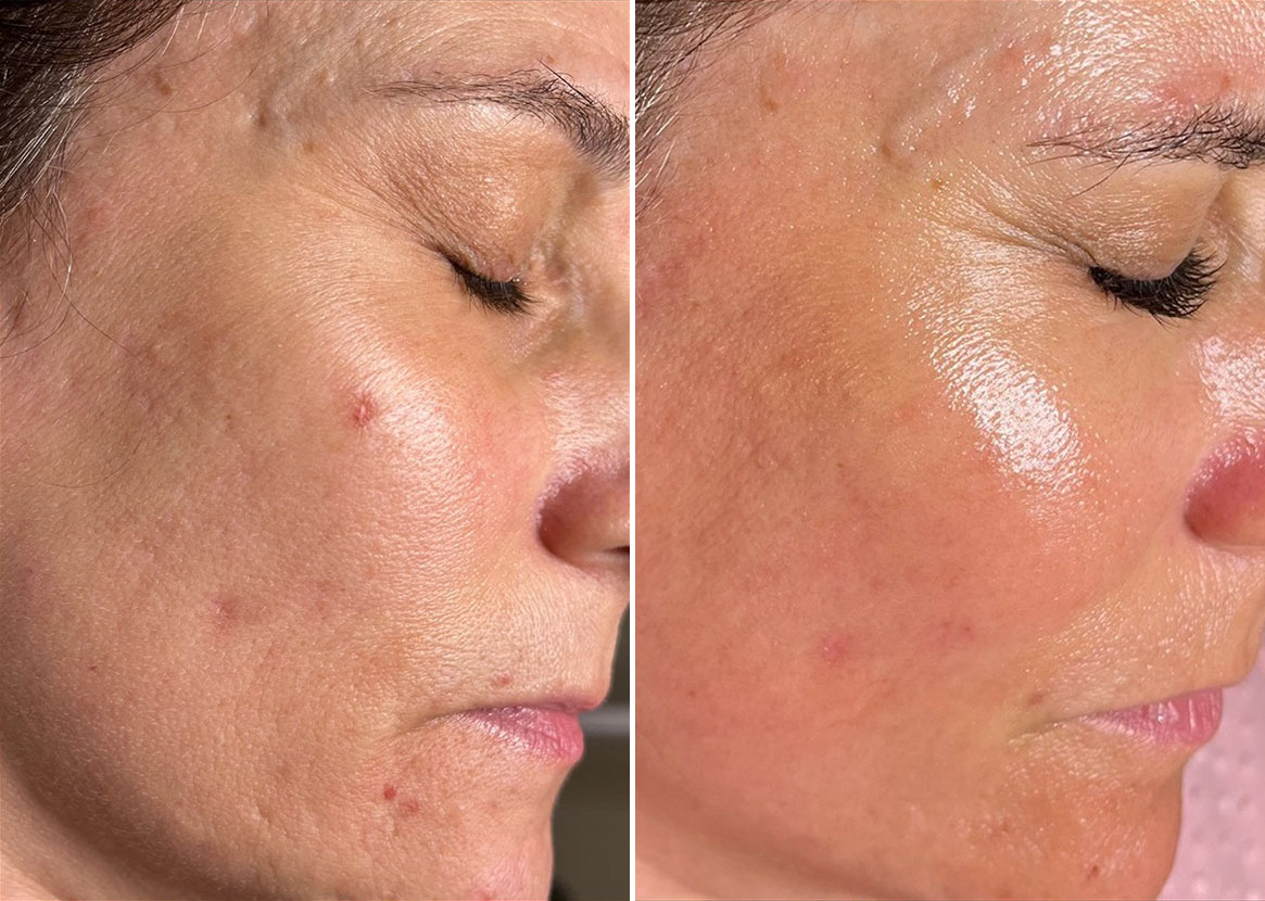 1735937034 before after 18