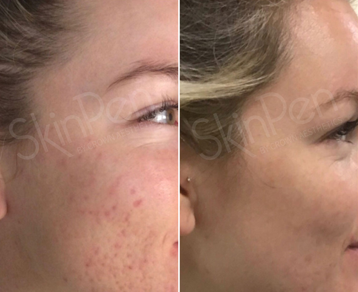 1736359403 before after 23